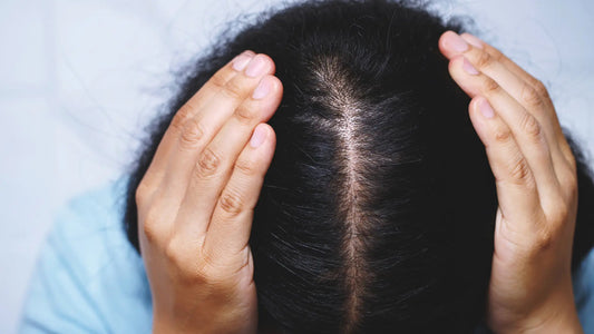 une femme qui as des problèmes de perte de cheveux